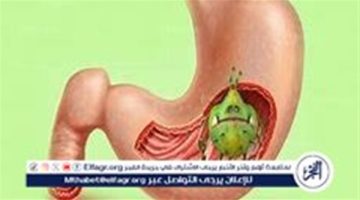 “جرثومة المعدة” الأسباب والأعراض وأثر المشروبات على الإصابة